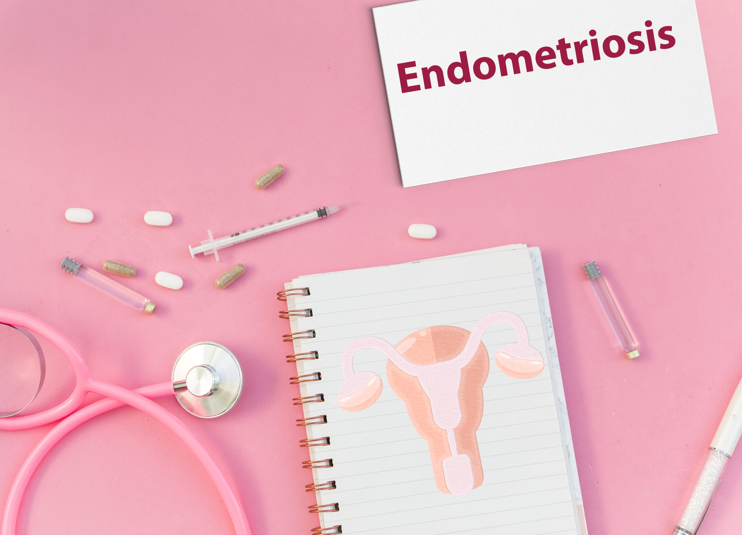 medical desk with notepad  showing endometriosis message.Pills, uterus.