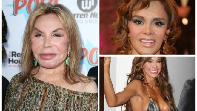 bad plastic surgery