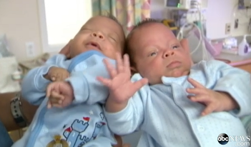 twins born 24 days apart