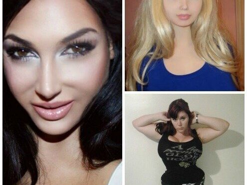 extreme plastic surgeries