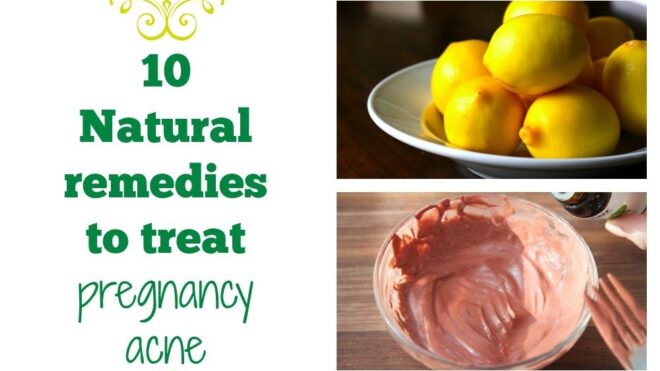 pregnancy acne home remedies