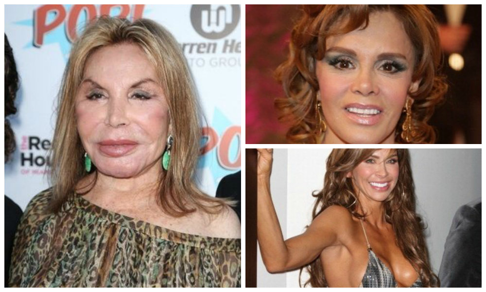 bad plastic surgery