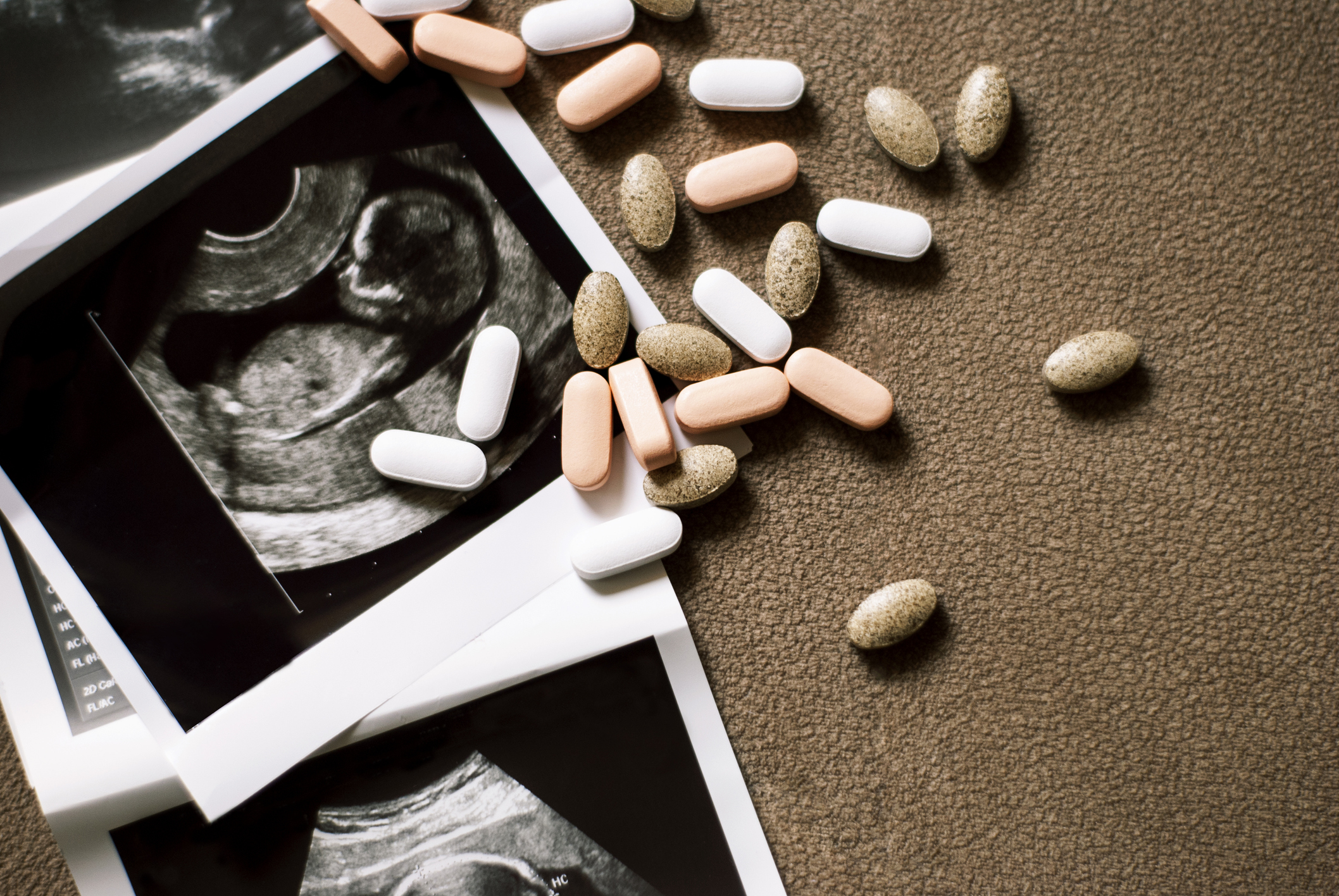 Photo of the fetus on an ultrasound scan and few pills on brown background