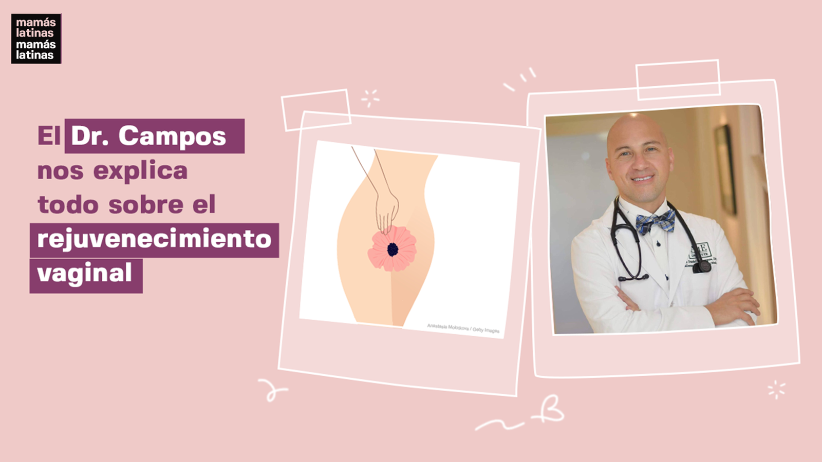 Todo sobre el rejuvenecimiento vaginal