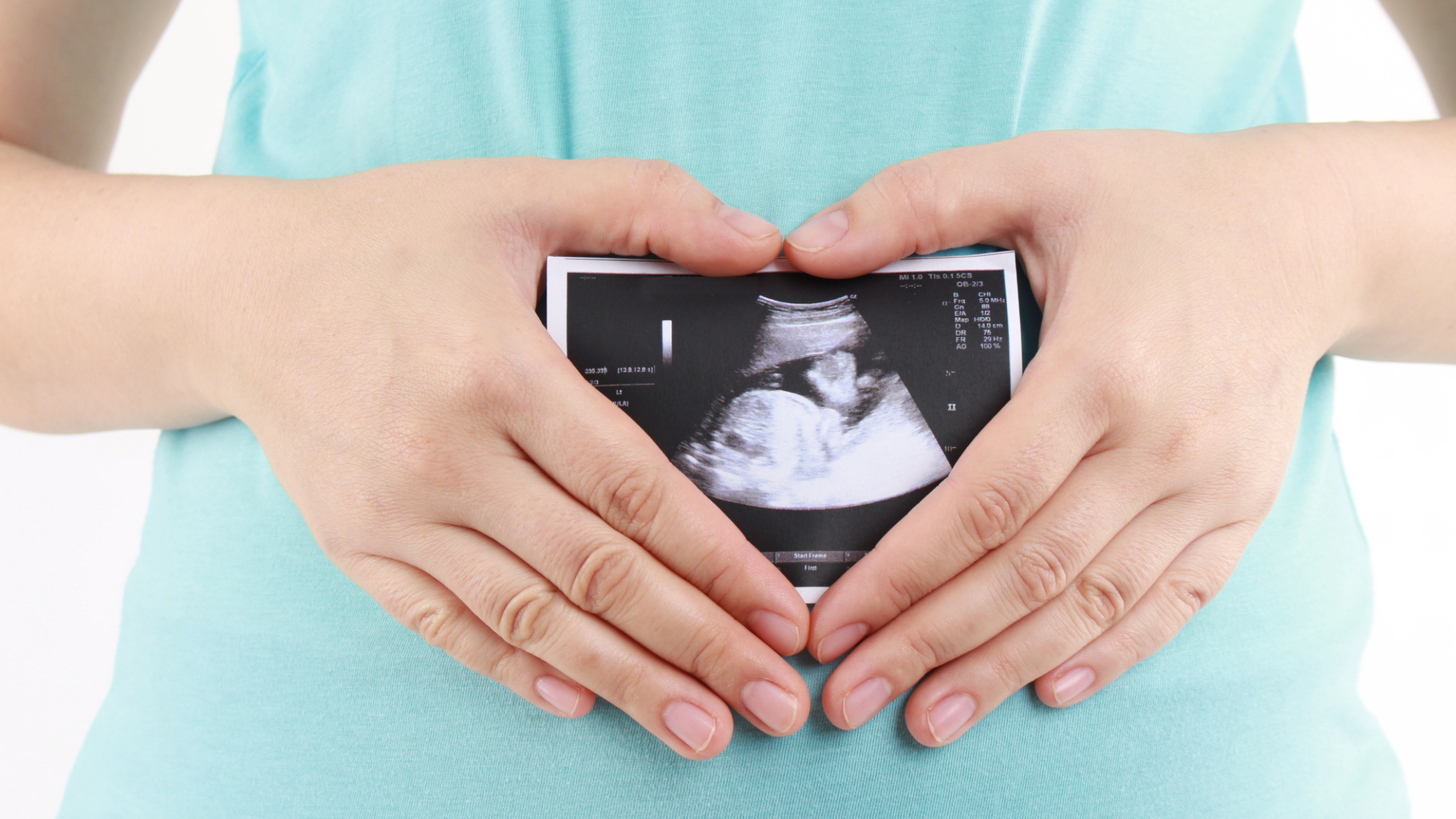 mujer sonograma bebe