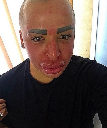 Jordan James Parke gets plastic surgery to look like Kim Kardashian