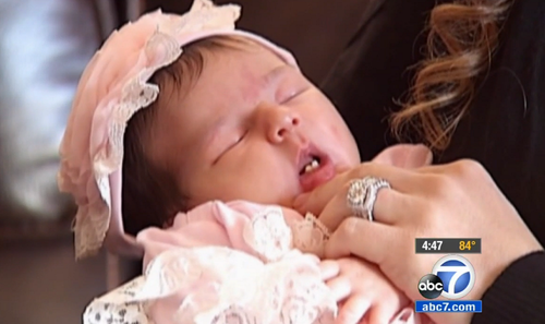 baby born with two front teeth