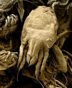 dust mite