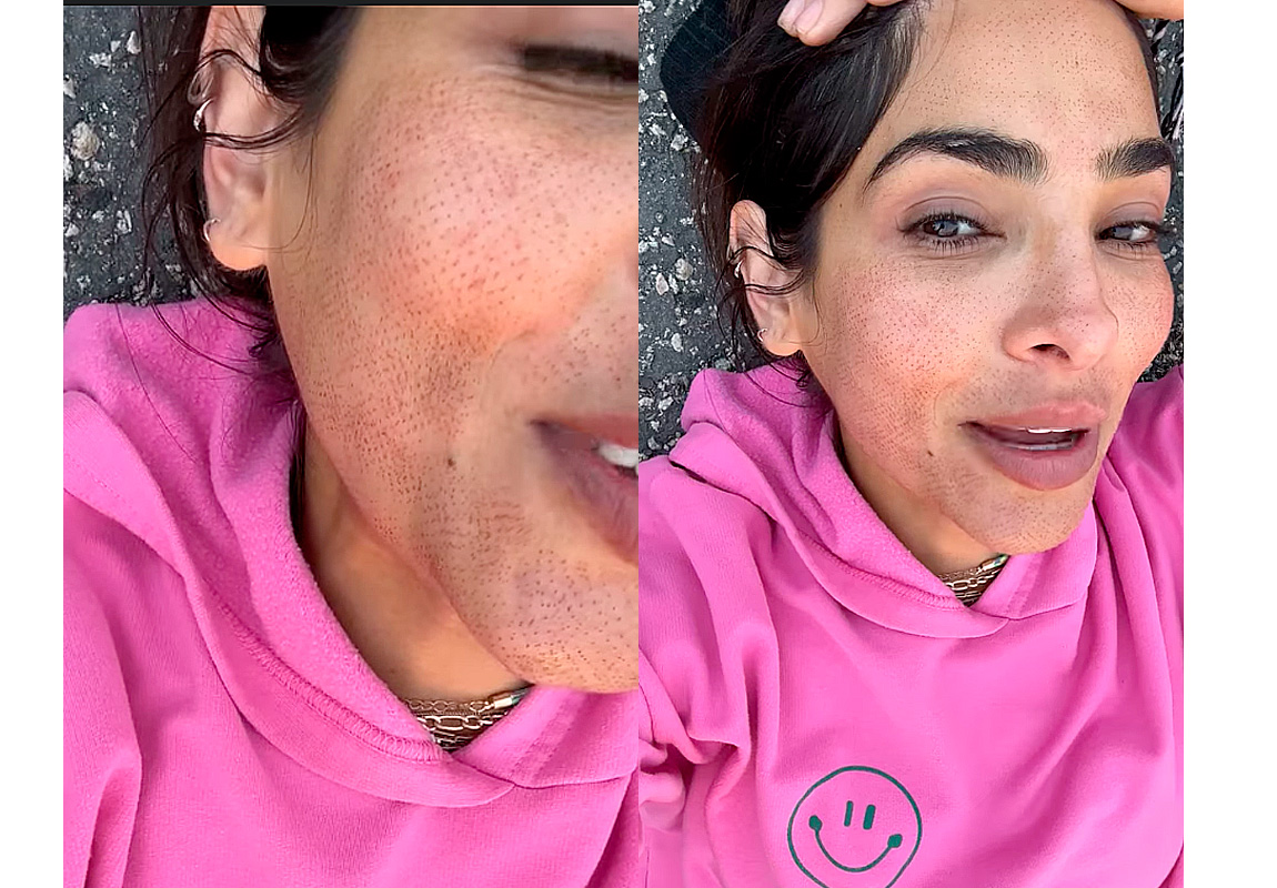 alejandra-espinoza-rostro-tratamiento.jpg