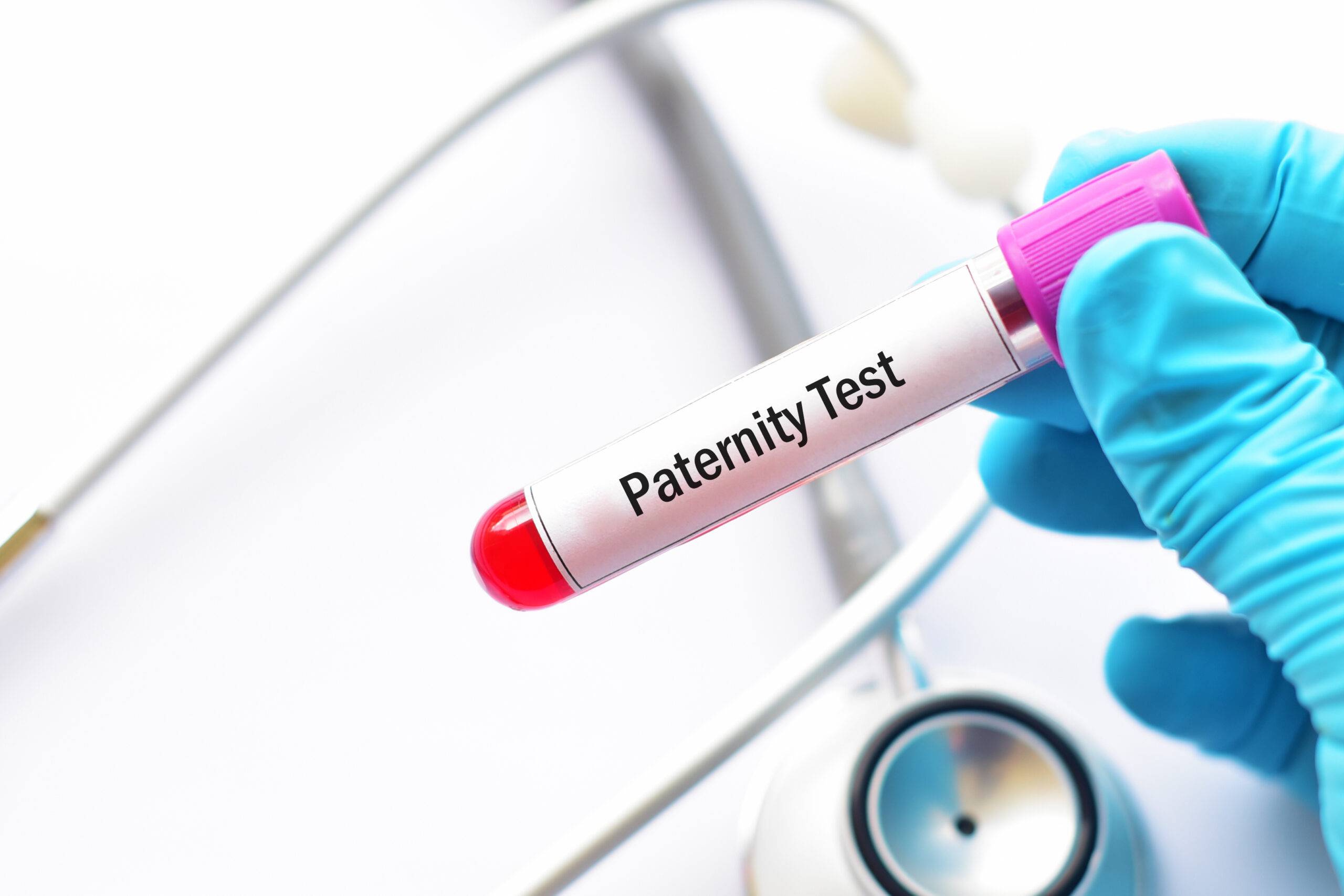 Blood sample for paternity test