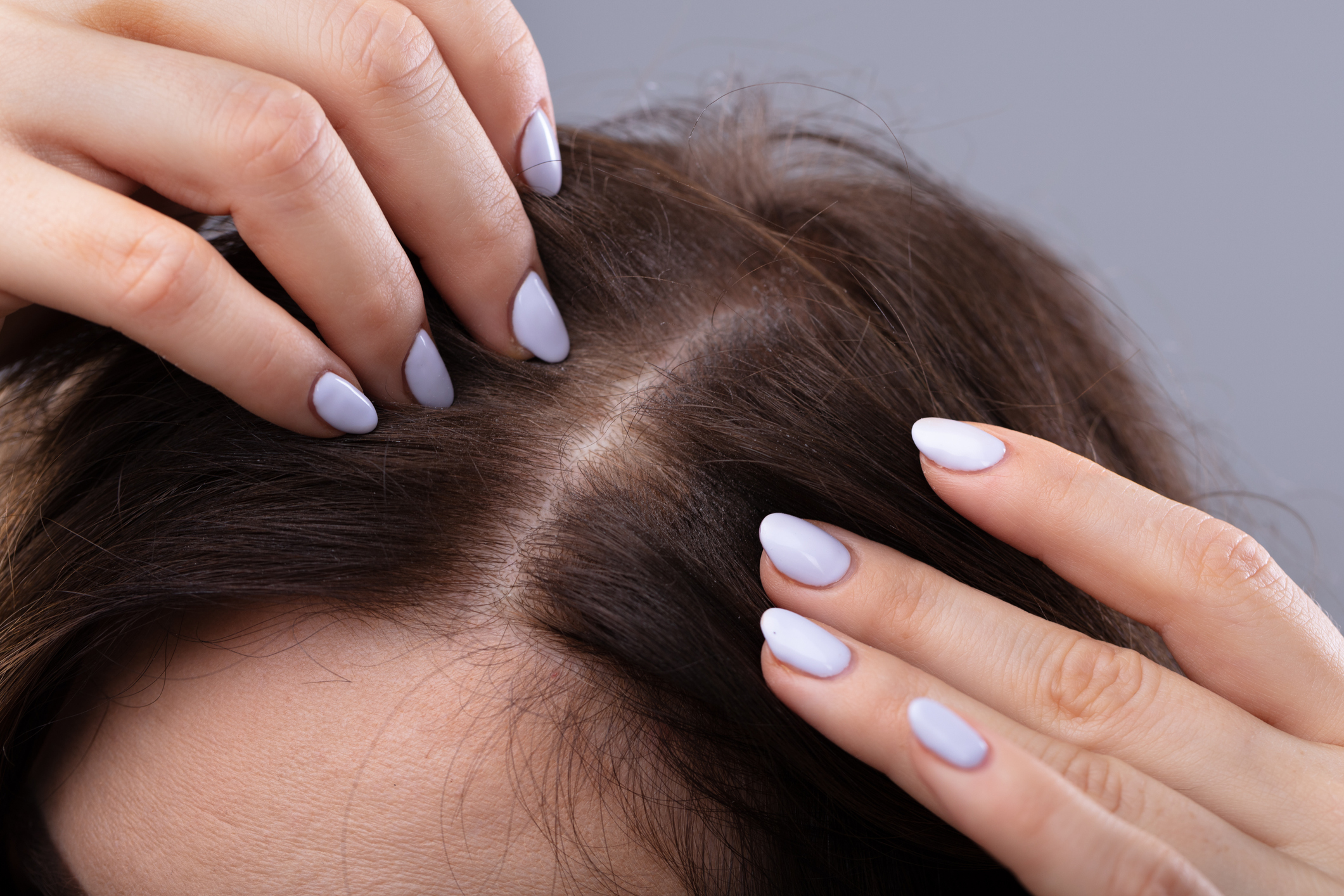 Woman With Thinning Hair