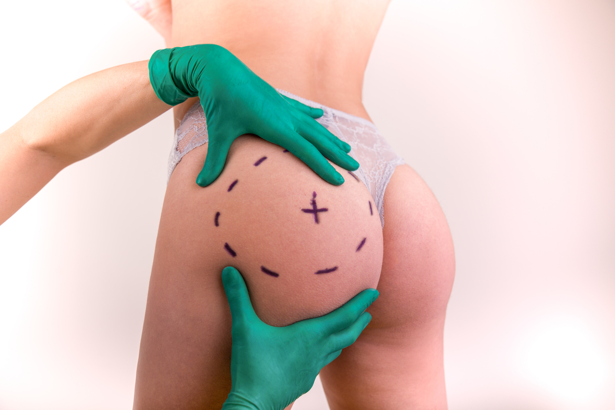 Surgeon drawing marks on female body before plastic operation, white background. Beautician touch and draw correction lines on woman's buttocks.