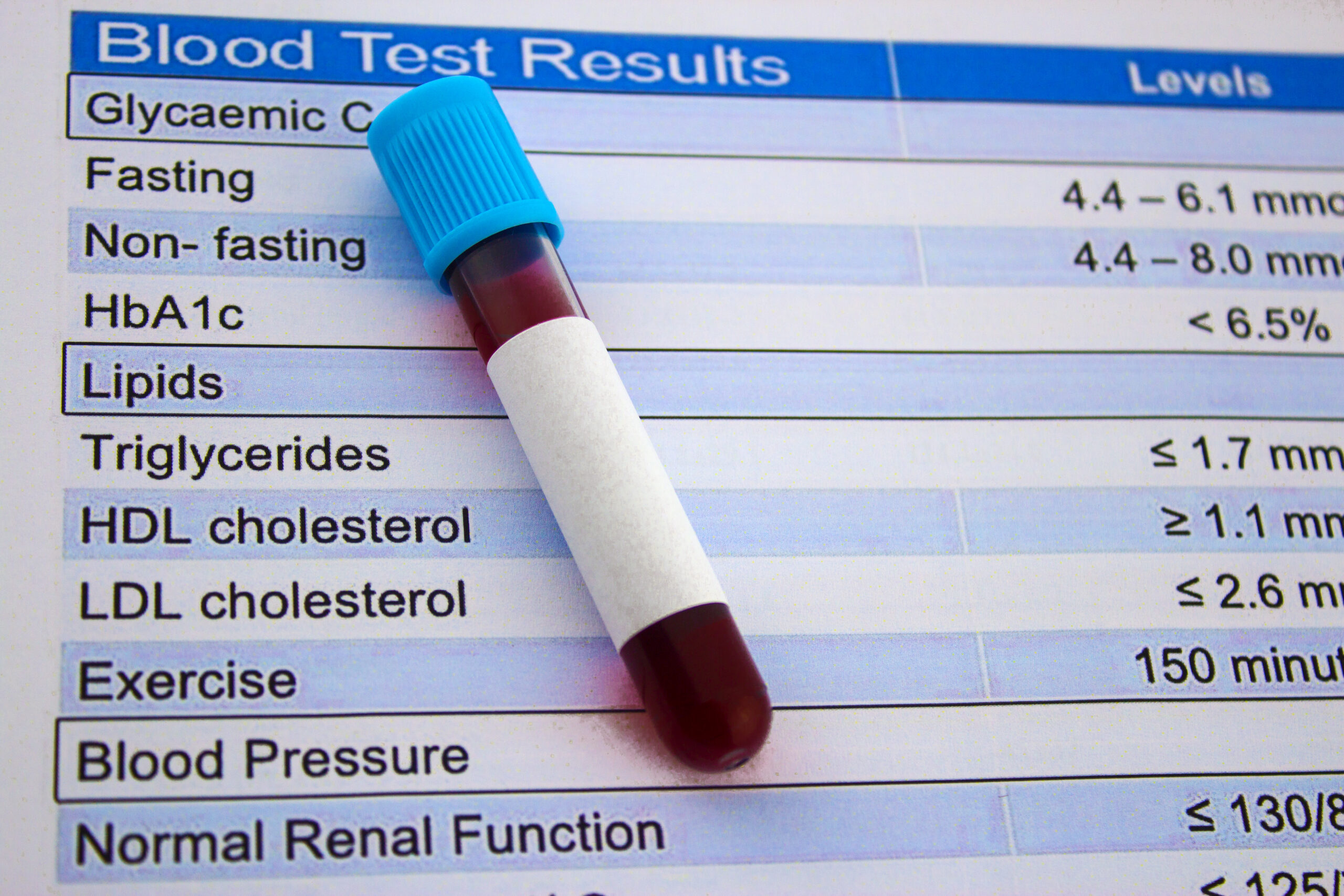 cholesterol test and blood test tube