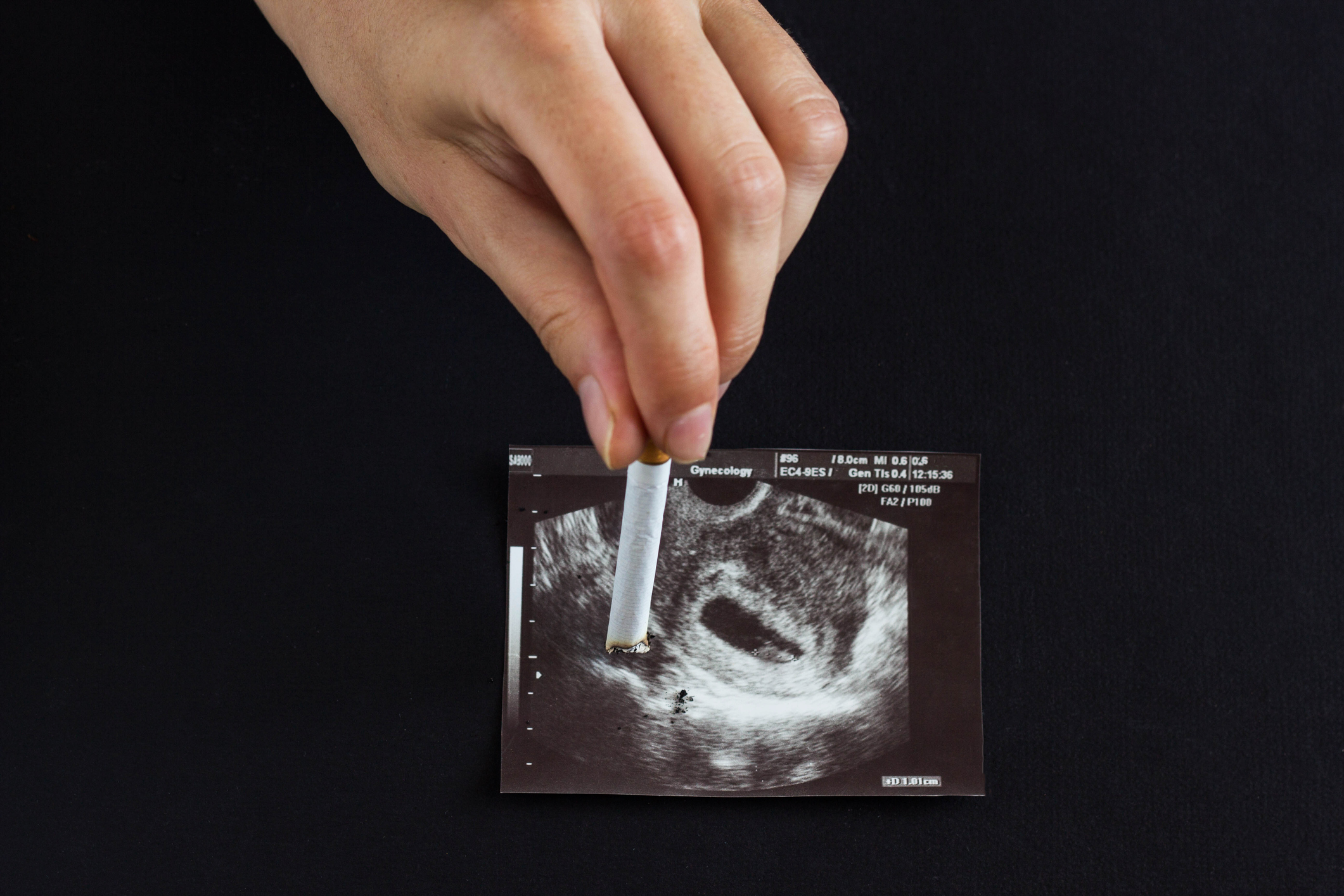 A woman's hand, a future mother extinguishes a cigarette on a picture of a pregnancy uzi, pregnancy and smoking, cigarette and pregnancy