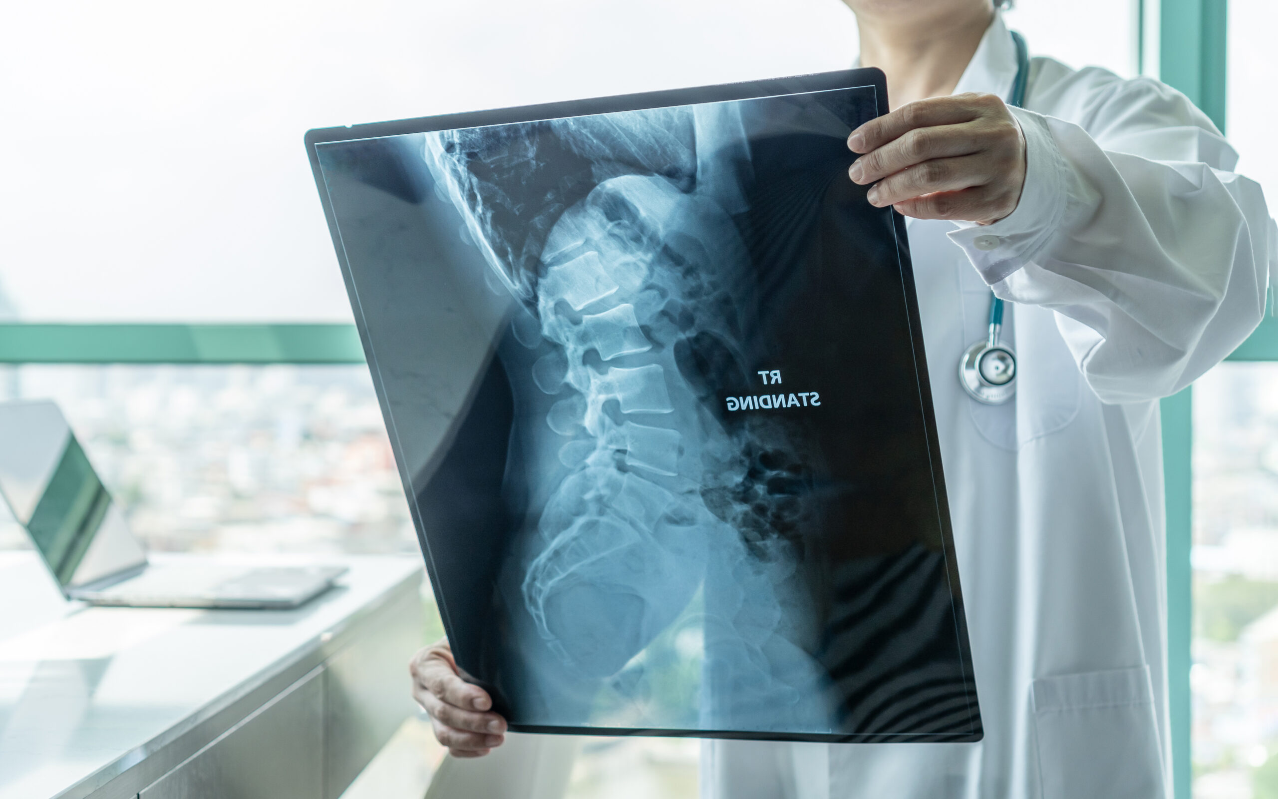 Surgical doctor looking at radiological spinal x-ray film for medical diagnosis on patient health on spine disease, bone cancer illness, spinal muscular atrophy, medical healthcare concept