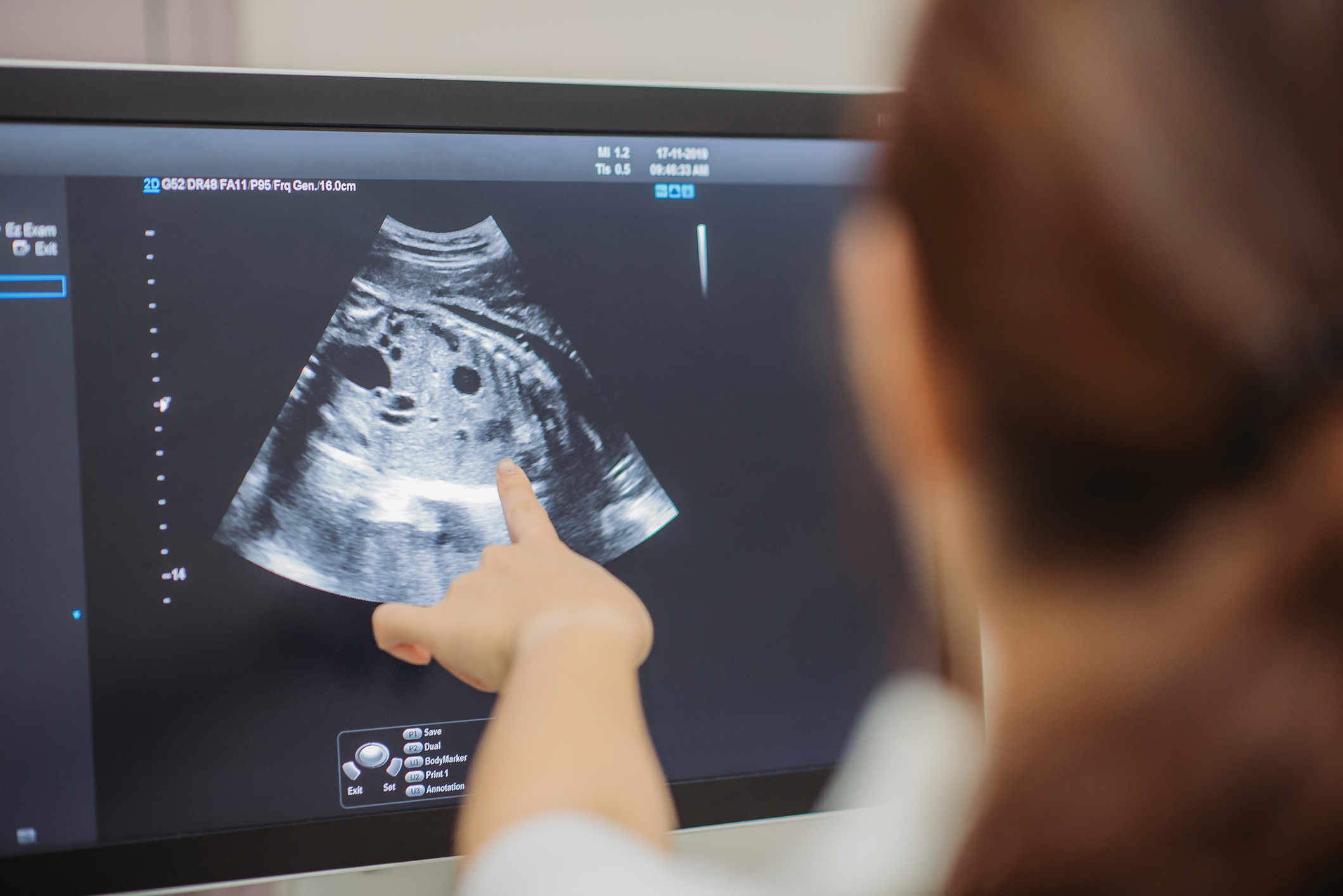 Close-up of asian chinese young doctor showing ultrasound scan on monitor to pregnant woman in doctor room at hospital