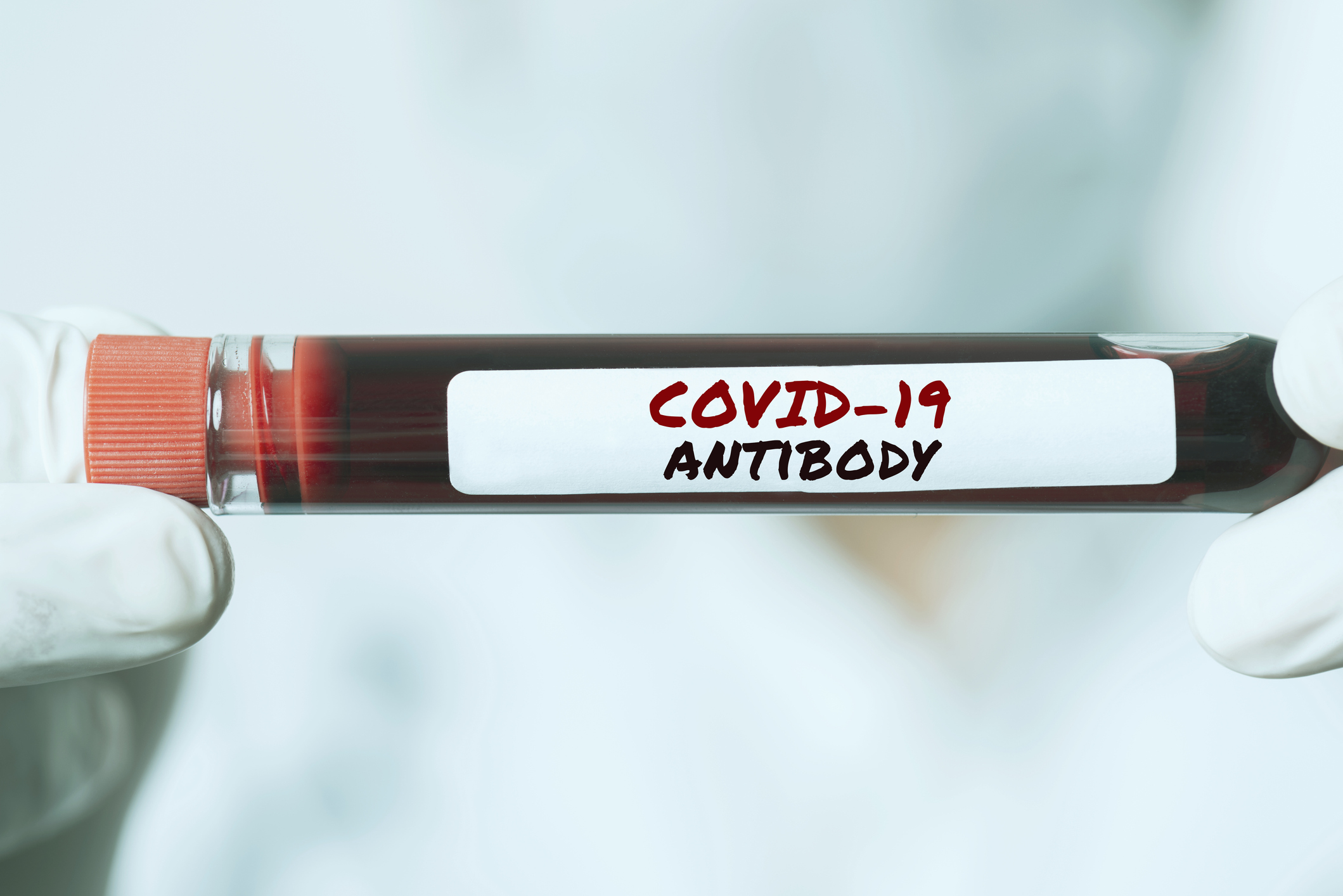 Covid-19 Antibody