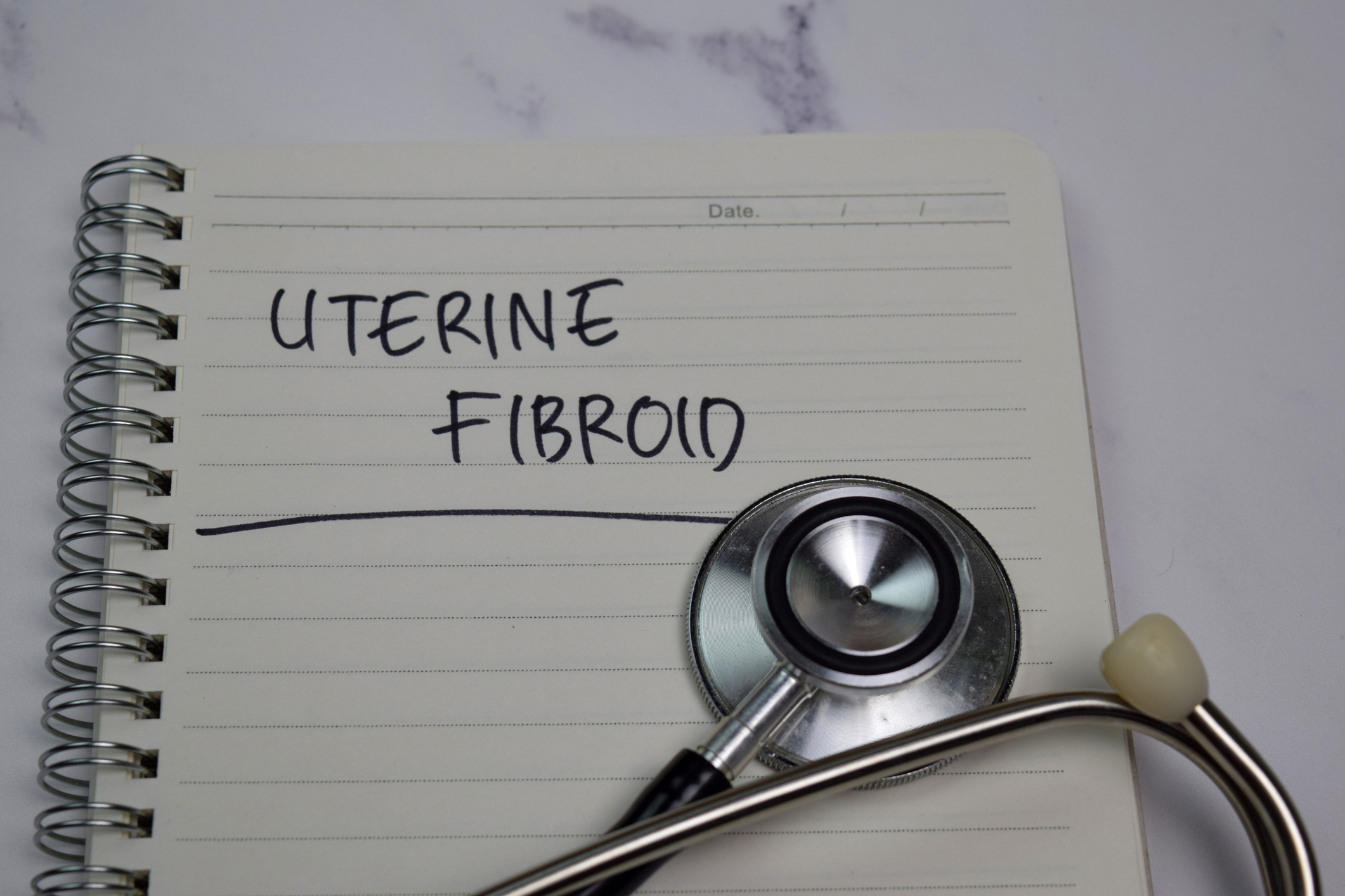 Uterine Fibroid on top view yellow table. Healthcare/medical concept.