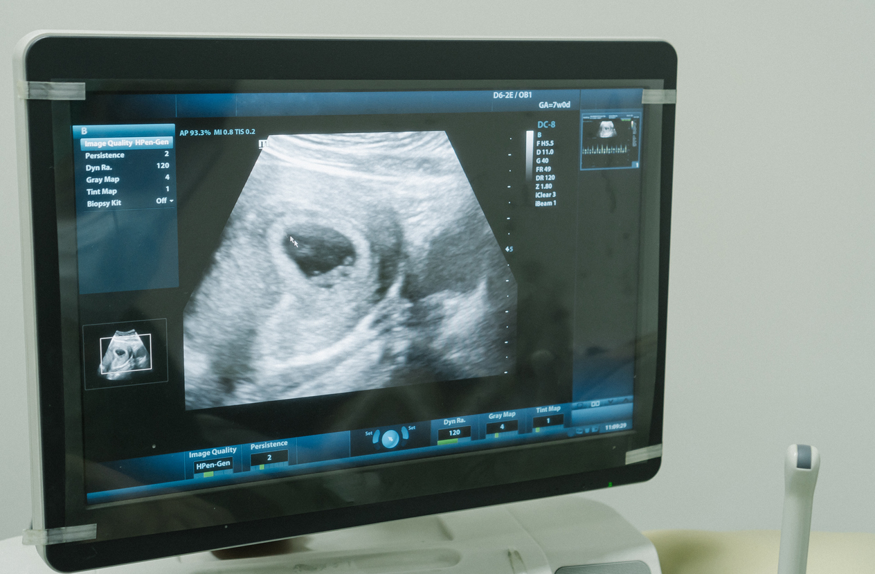 Ultrasonography of Baby