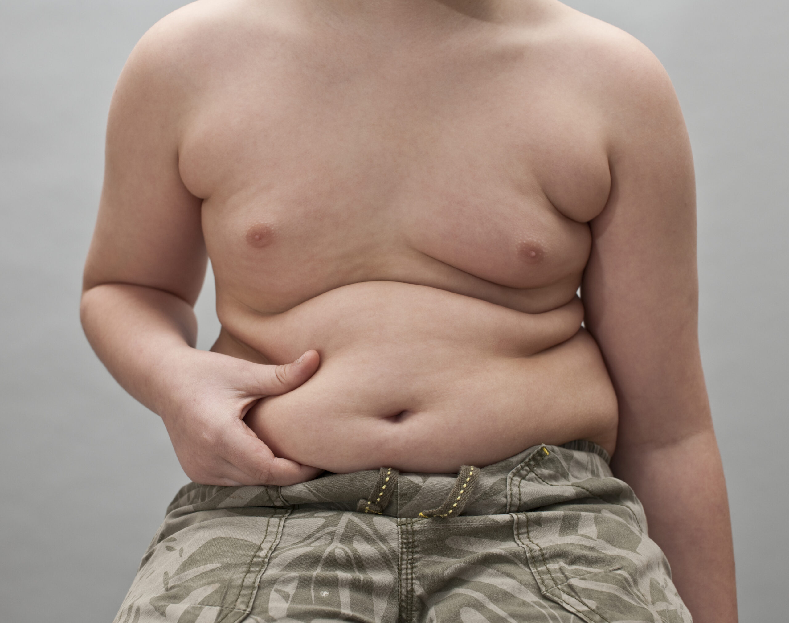 Overweight Boy Holding his stomach