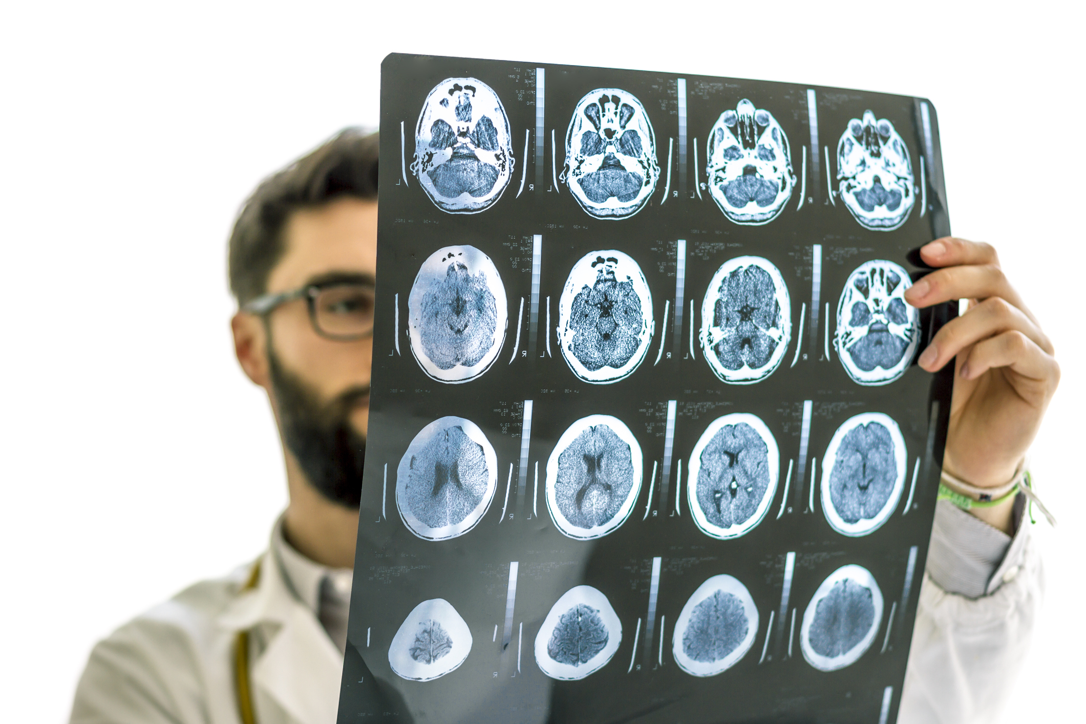 Hipster Doctor examining the x-ray of brain