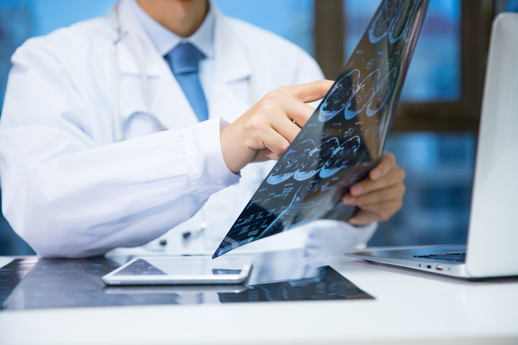 Doctor checking magnetic resonance image (MRI)  photo