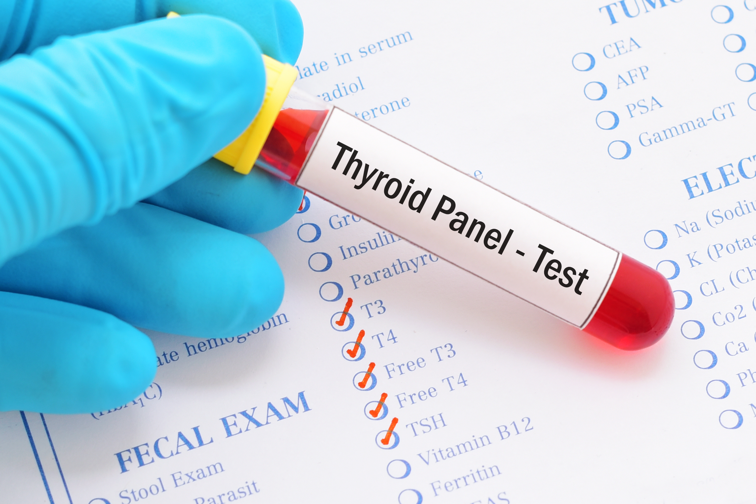 Thyroid panel test