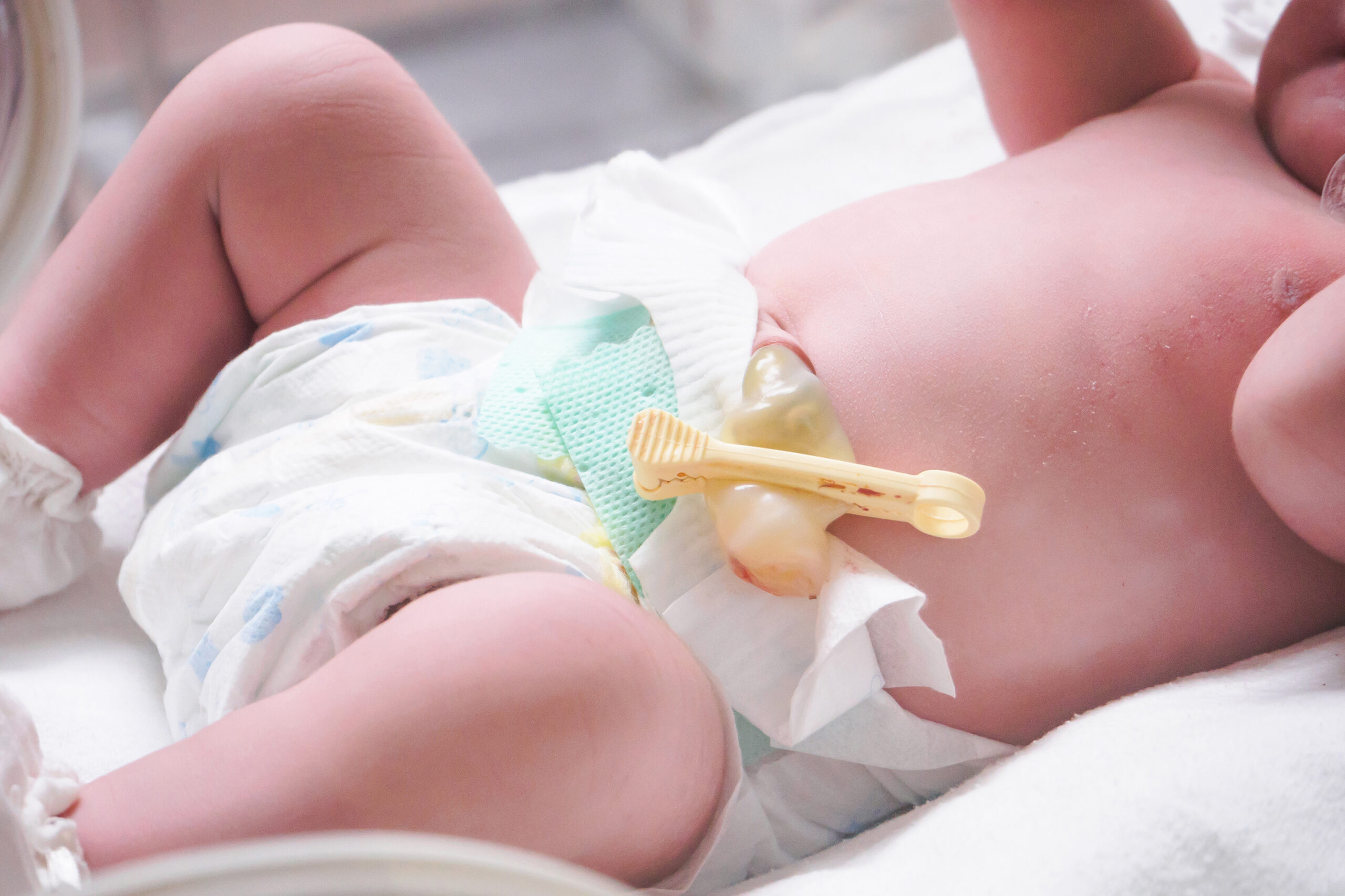 Newborn baby girl inside incubator in hospital post delivery room