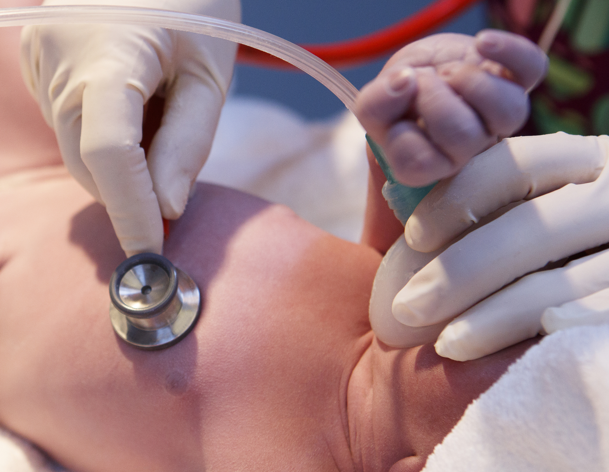 Doctor checking a newborn