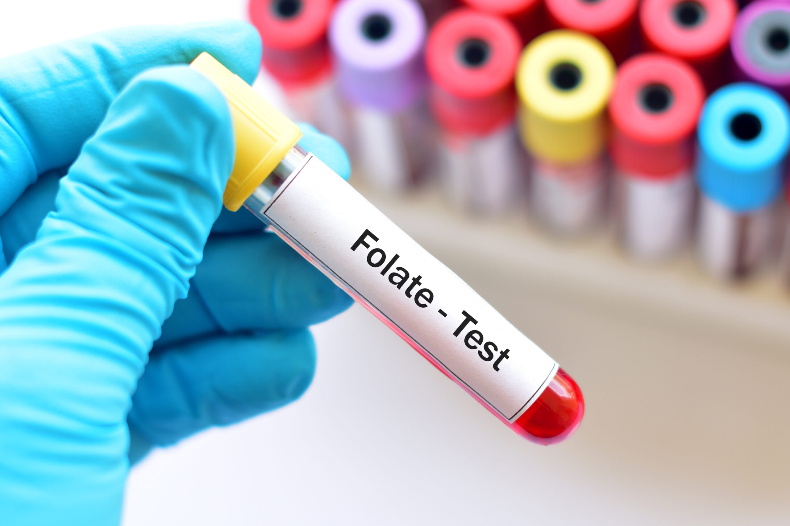 Blood sample for folate test