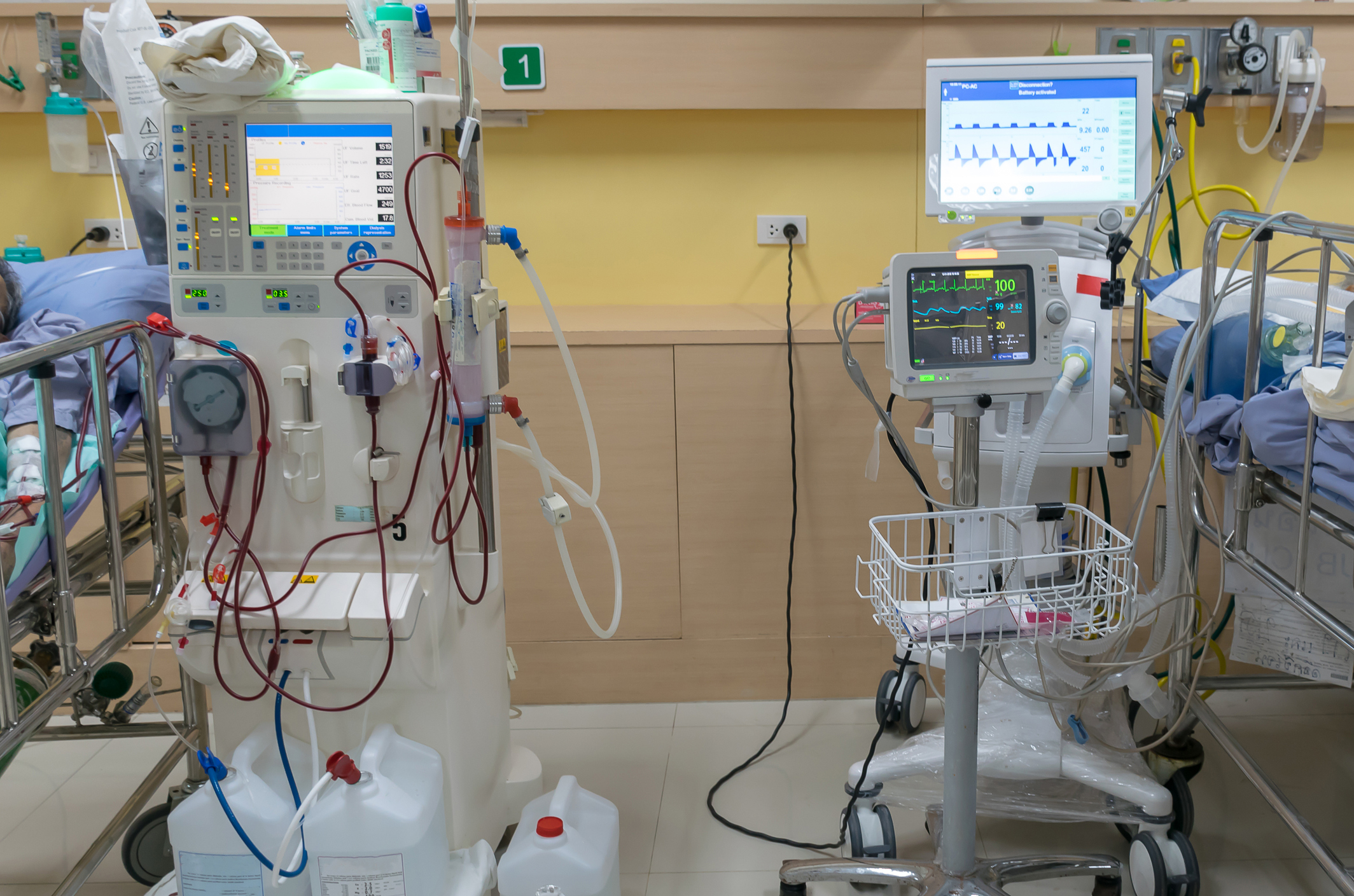 Dialysis machine Kidney Clean blood Blood filter in a hospital