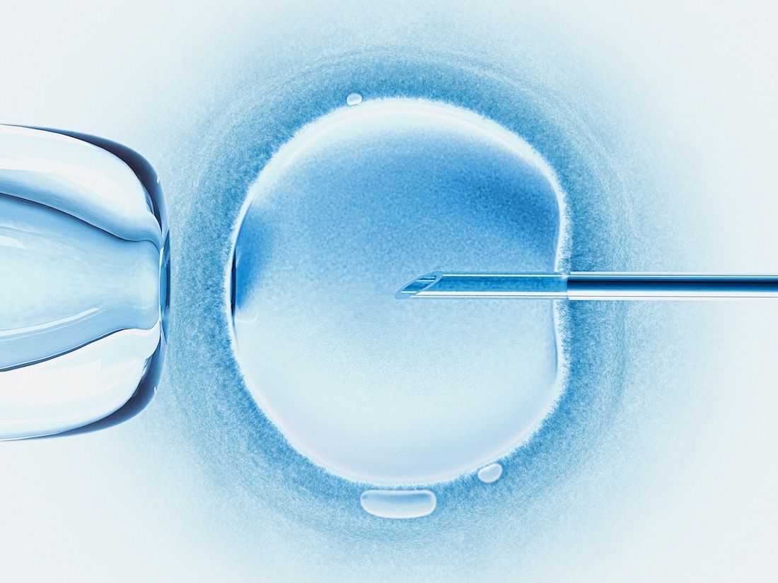 In vitro fertilisation, artwork