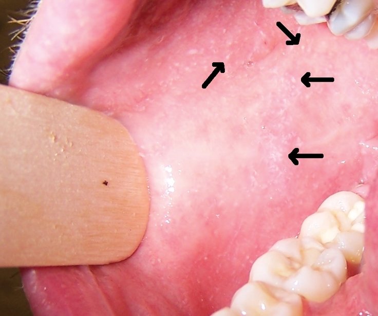 ph8dmtfr401-1.jpg