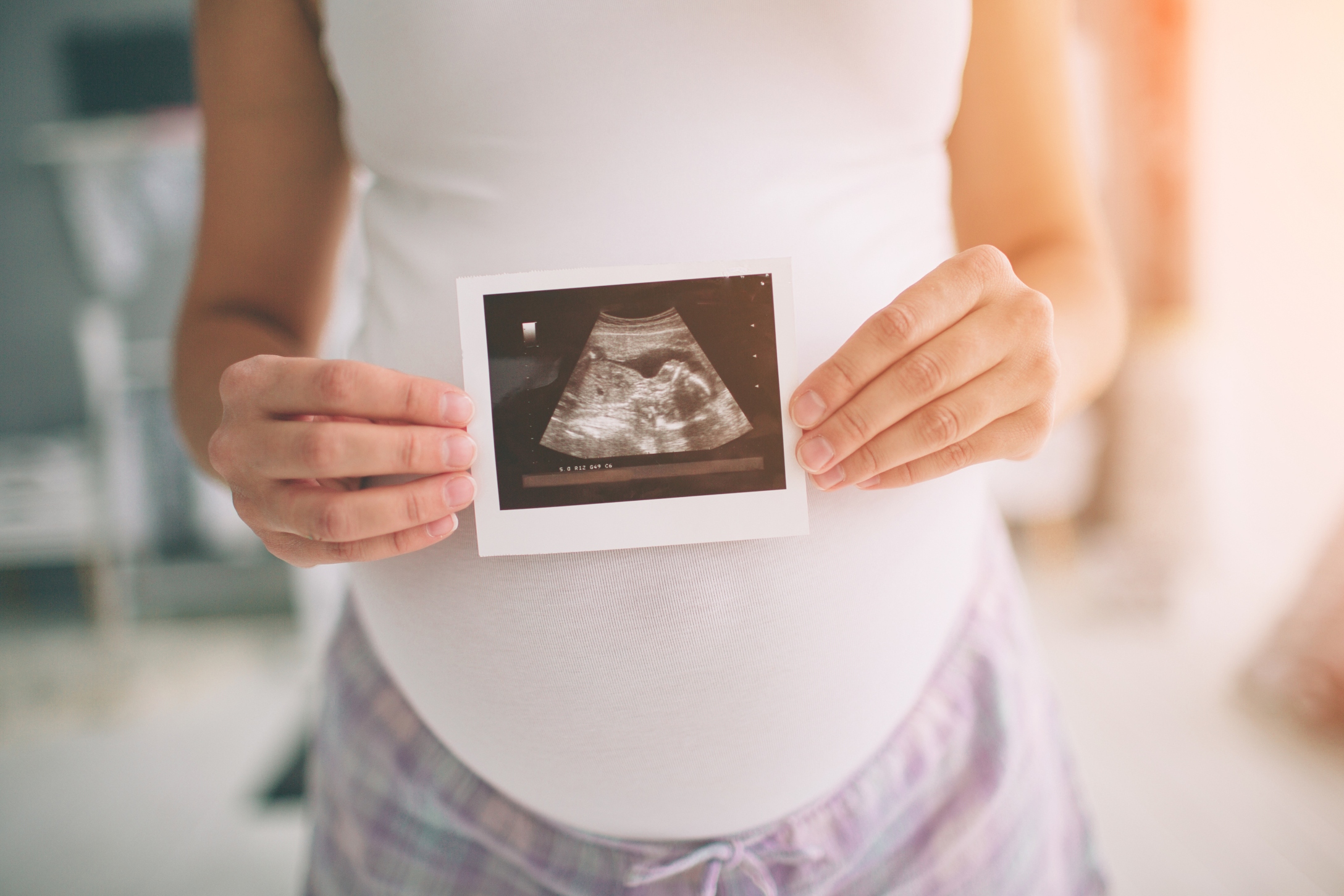 Pregnant woman holding ultrasound scan. Concept of Pregnancy health care.